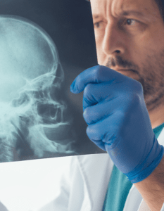 Photo of a doctor examining an x-ray of a person's skull